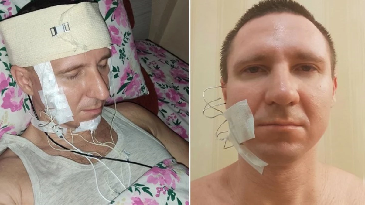 Rusya'da rüyalarını kontrol etmek isteyen adamın ilginç yöntemi! Kafasını matkapla beynini delerek çip yerleştirmek istedi