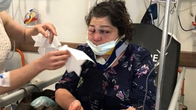 Belediye başkanının yanındakiler kadını darbetti, başkan kendini 